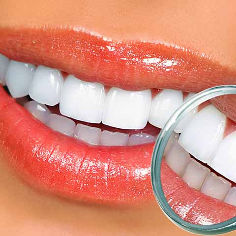 Фото отбеленных зубов крупным планом и в стоматологическом зеркале