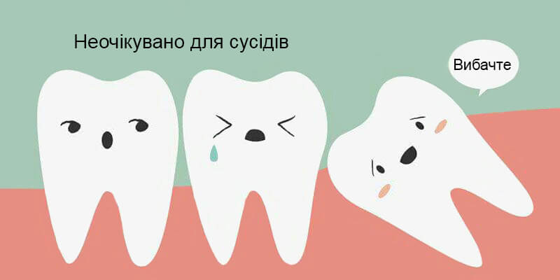 Зуб мудрості зміщує зубний ряд