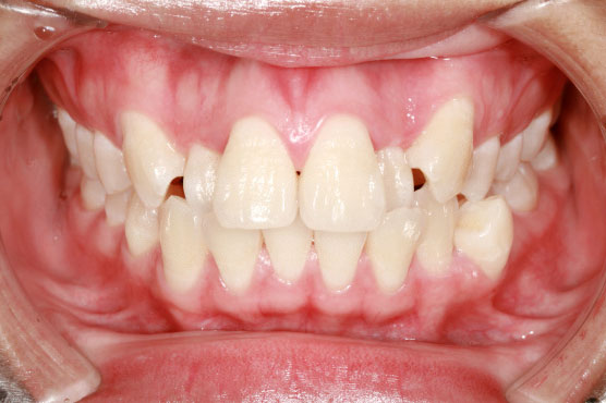 Ортодонтическая патология