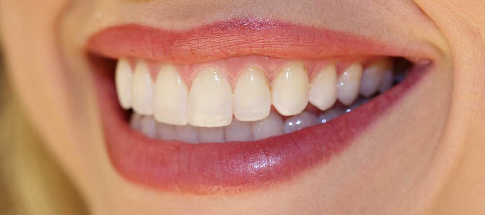 Типы и причины окрашивания зубов » вики полезно Cinoll