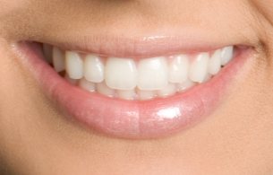 Ровные зубы и красвая улыбка