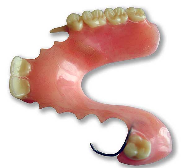 Зубные протезы, съемный протез